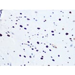 Immunohistochemistry - Anti-RNA Helicase A Antibody [ARC1033] (A306342) - Antibodies.com