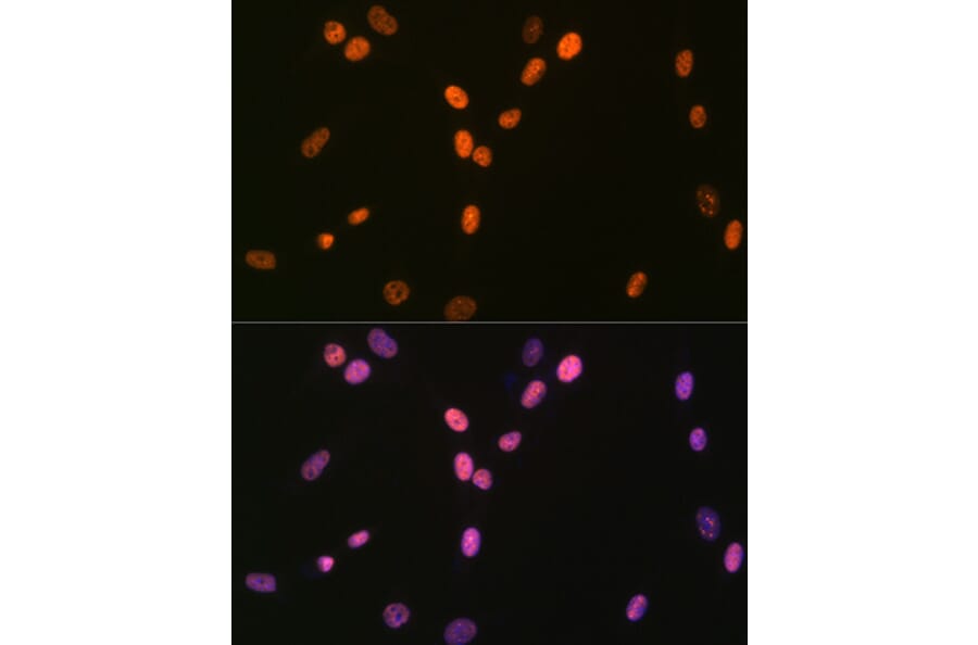 Immunofluorescence - Anti-RNA Helicase A Antibody [ARC1033] (A306342) - Antibodies.com
