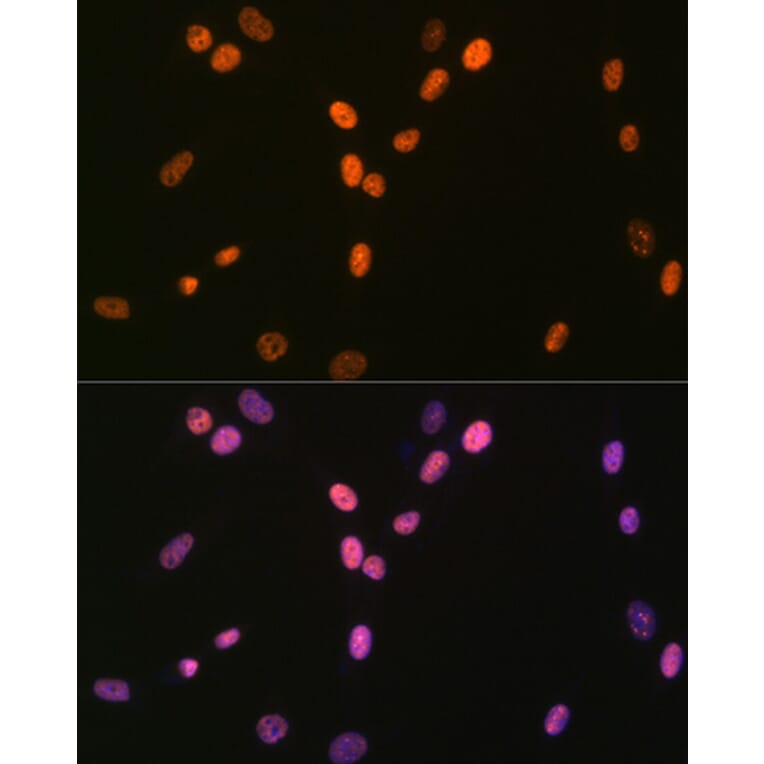 Immunofluorescence - Anti-RNA Helicase A Antibody [ARC1033] (A306342) - Antibodies.com