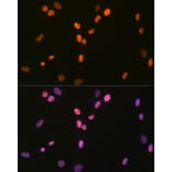 Immunofluorescence - Anti-RNA Helicase A Antibody [ARC1033] (A306342) - Antibodies.com
