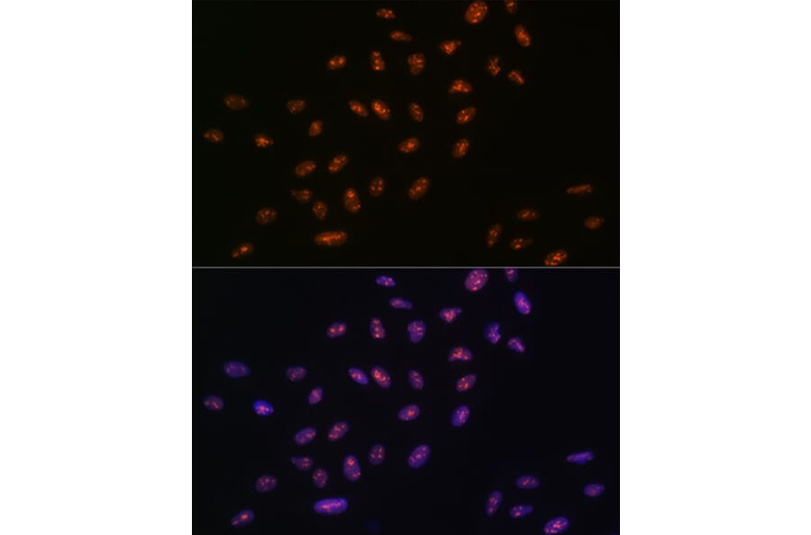 Immunofluorescence - Anti-RNA Helicase A Antibody [ARC1033] (A306342) - Antibodies.com
