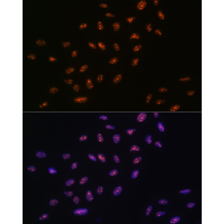 Immunofluorescence - Anti-RNA Helicase A Antibody [ARC1033] (A306342) - Antibodies.com