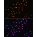 Immunofluorescence - Anti-RNA Helicase A Antibody [ARC1033] (A306342) - Antibodies.com