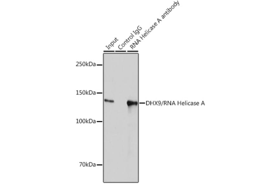 Western Blot - Anti-RNA Helicase A Antibody [ARC1033] (A306342) - Antibodies.com