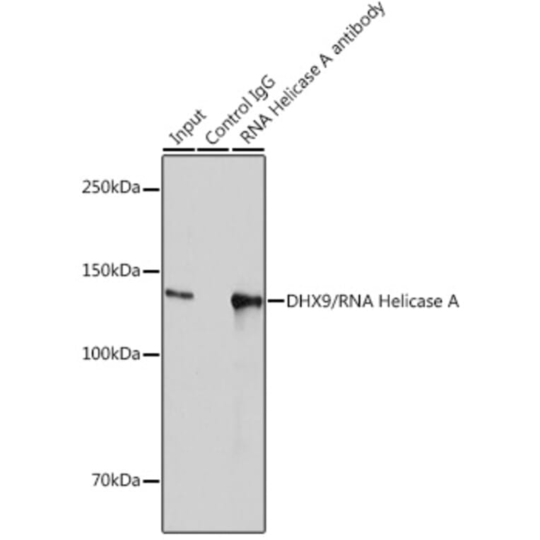 Western Blot - Anti-RNA Helicase A Antibody [ARC1033] (A306342) - Antibodies.com