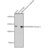 Western Blot - Anti-RNA Helicase A Antibody [ARC1033] (A306342) - Antibodies.com