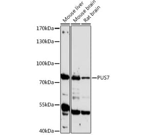 Western Blot - Anti-PUS7 Antibody (A306343) - Antibodies.com