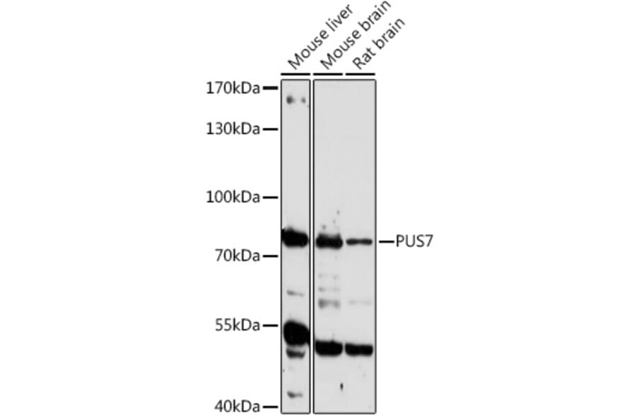 Western Blot - Anti-PUS7 Antibody (A306343) - Antibodies.com
