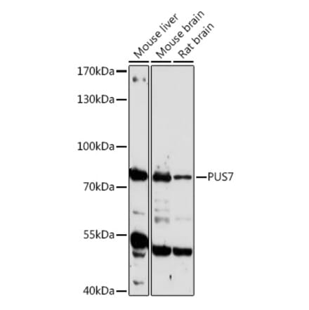 Western Blot - Anti-PUS7 Antibody (A306343) - Antibodies.com
