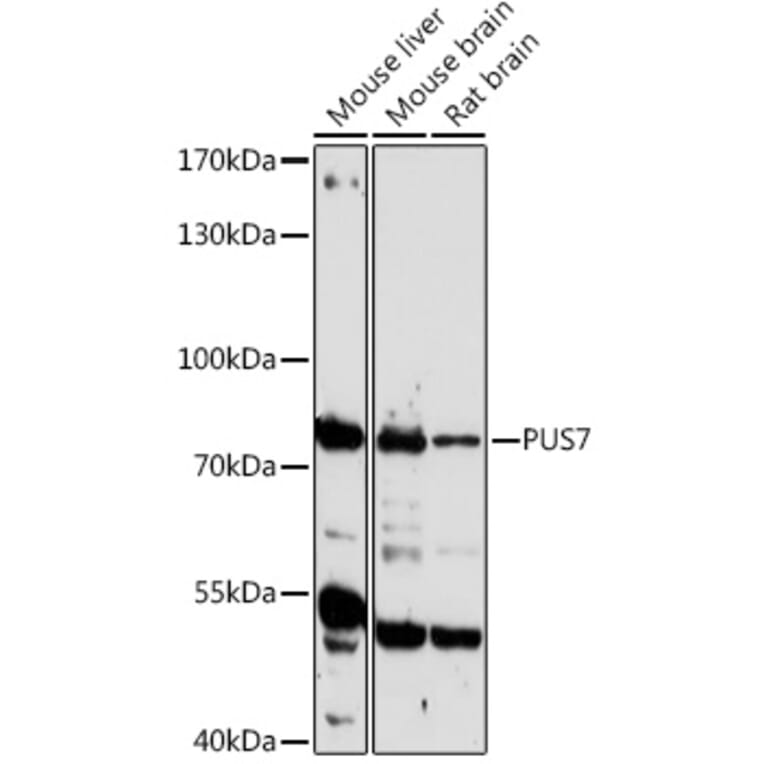 Western Blot - Anti-PUS7 Antibody (A306343) - Antibodies.com