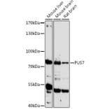 Western Blot - Anti-PUS7 Antibody (A306343) - Antibodies.com
