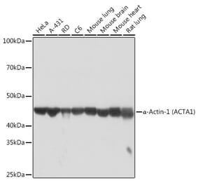Western Blot - Anti-muscle Actin Antibody [ARC1914] (A306344) - Antibodies.com