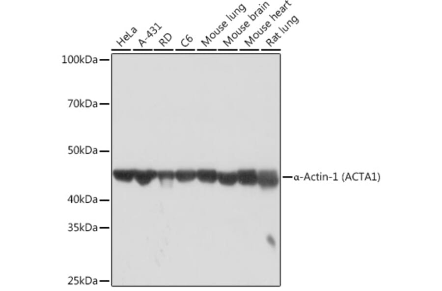 Western Blot - Anti-muscle Actin Antibody [ARC1914] (A306344) - Antibodies.com