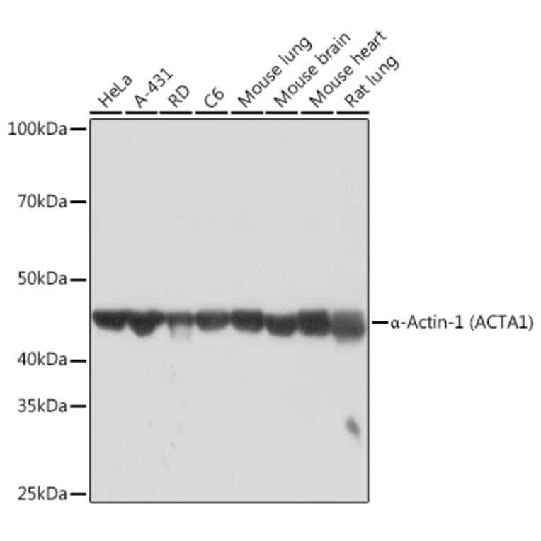 Western Blot - Anti-muscle Actin Antibody [ARC1914] (A306344) - Antibodies.com