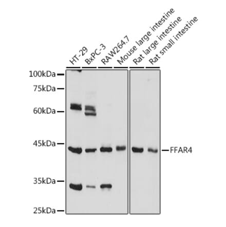 Western Blot - Anti-GPCR GPR120 Antibody (A306345) - Antibodies.com