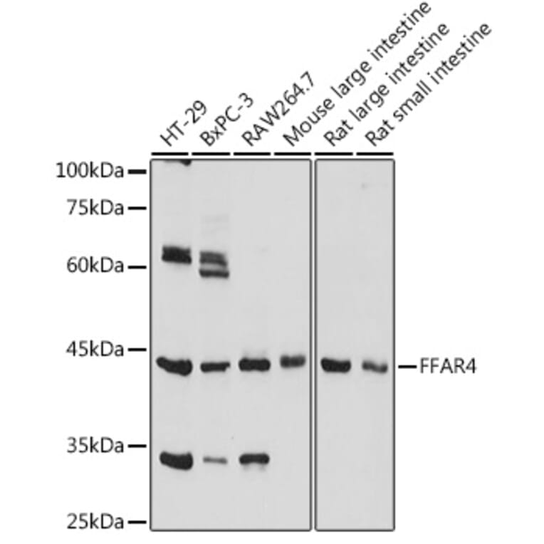 Western Blot - Anti-GPCR GPR120 Antibody (A306345) - Antibodies.com