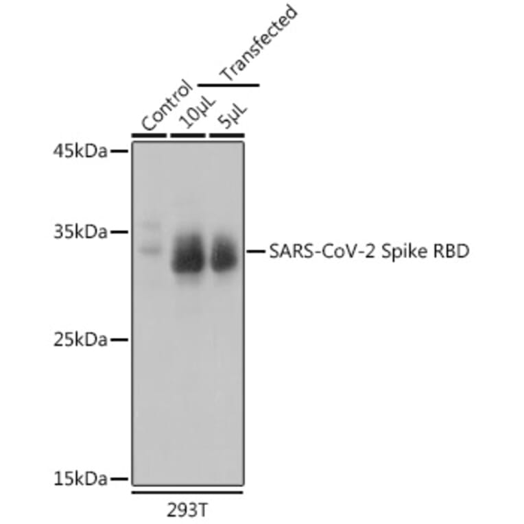 Western Blot - Anti-SARS-CoV-2 Spike Glycoprotein RBD Antibody (A306346) - Antibodies.com