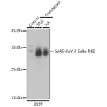 Western Blot - Anti-SARS-CoV-2 Spike Glycoprotein RBD Antibody (A306346) - Antibodies.com