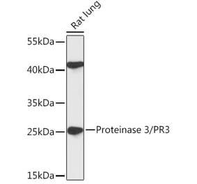 Western Blot - Anti-PR3 Antibody (A306347) - Antibodies.com