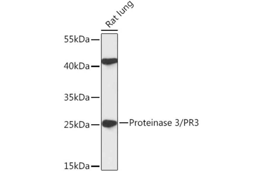 Western Blot - Anti-PR3 Antibody (A306347) - Antibodies.com