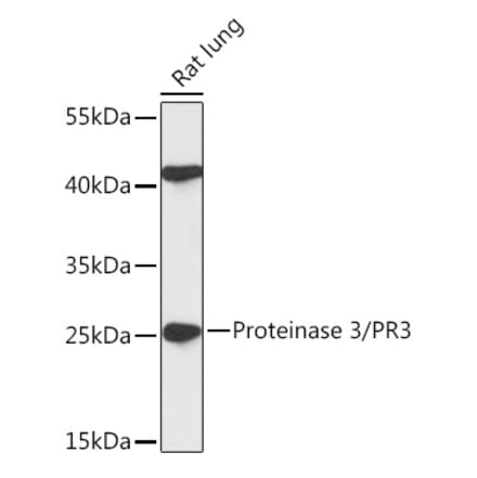 Western Blot - Anti-PR3 Antibody (A306347) - Antibodies.com