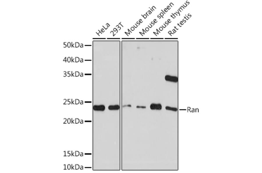Western Blot - Anti-Ran Antibody [ARC0986] (A306349) - Antibodies.com