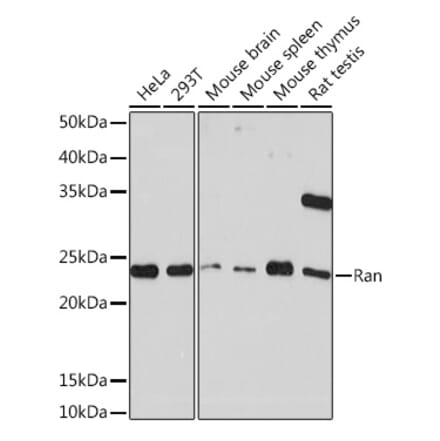 Western Blot - Anti-Ran Antibody [ARC0986] (A306349) - Antibodies.com