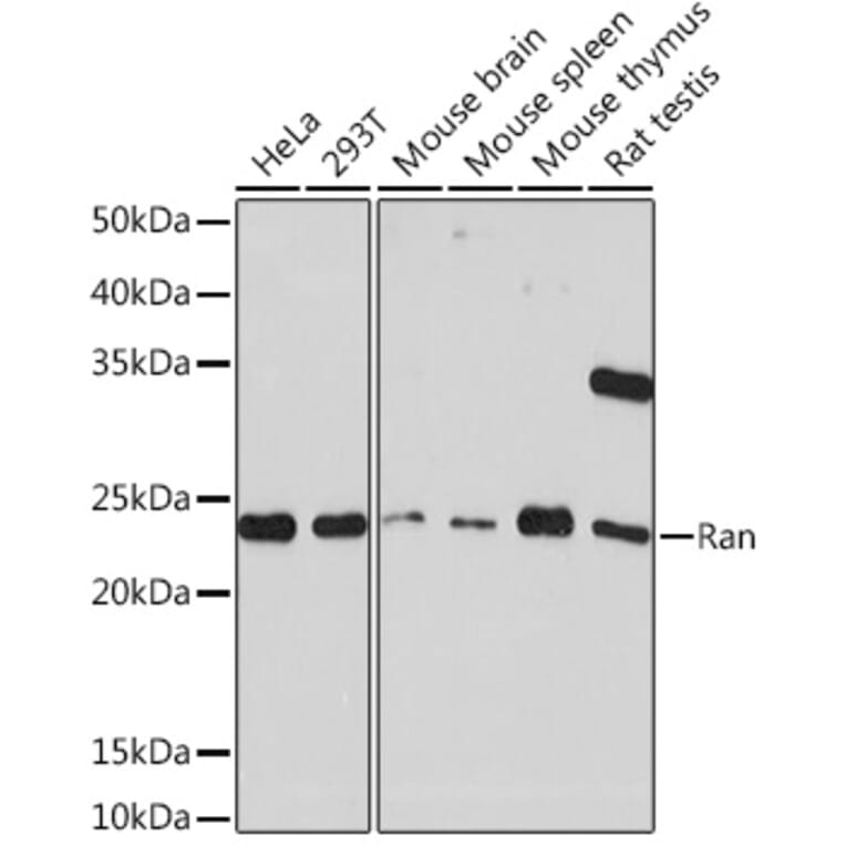 Western Blot - Anti-Ran Antibody [ARC0986] (A306349) - Antibodies.com