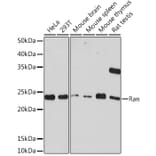 Western Blot - Anti-Ran Antibody [ARC0986] (A306349) - Antibodies.com