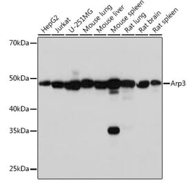 Western Blot - Anti-Arp3 Antibody [ARC1067] (A306350) - Antibodies.com