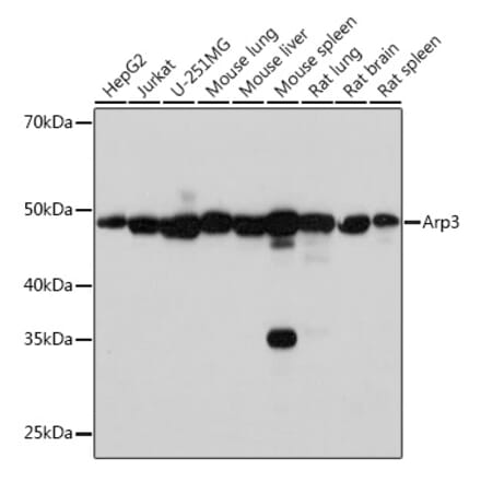 Western Blot - Anti-Arp3 Antibody [ARC1067] (A306350) - Antibodies.com