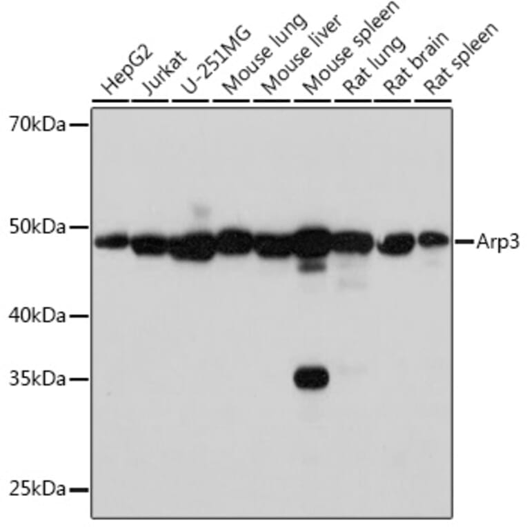 Western Blot - Anti-Arp3 Antibody [ARC1067] (A306350) - Antibodies.com