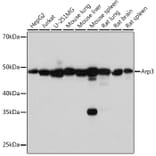 Western Blot - Anti-Arp3 Antibody [ARC1067] (A306350) - Antibodies.com