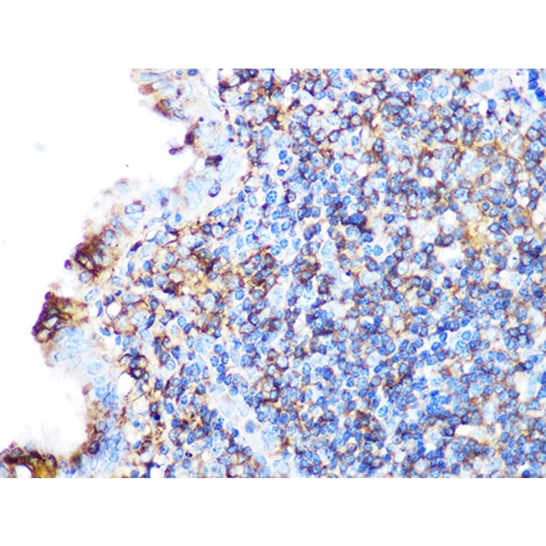 Immunohistochemistry - Anti-Arp3 Antibody [ARC1067] (A306350) - Antibodies.com