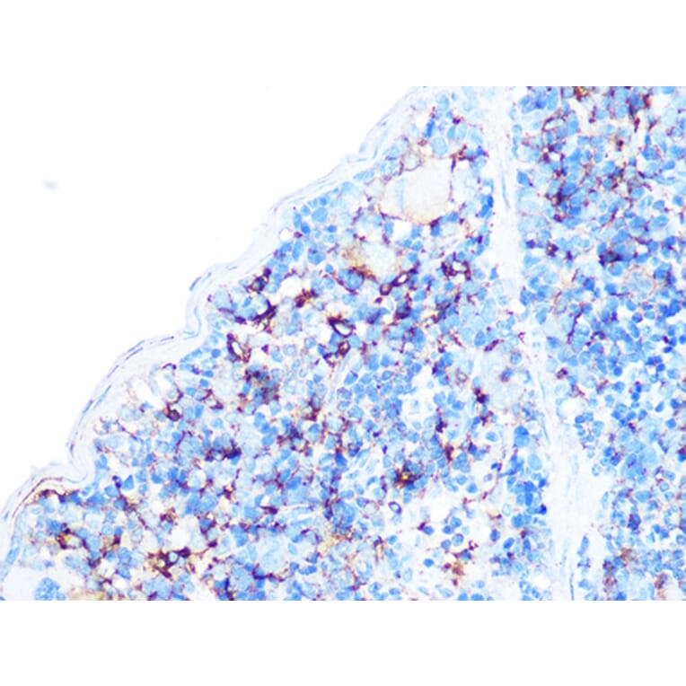 Immunohistochemistry - Anti-Arp3 Antibody [ARC1067] (A306350) - Antibodies.com