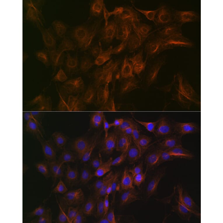 Immunofluorescence - Anti-Arp3 Antibody [ARC1067] (A306350) - Antibodies.com