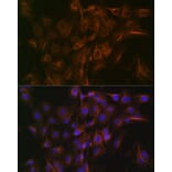 Immunofluorescence - Anti-Arp3 Antibody [ARC1067] (A306350) - Antibodies.com