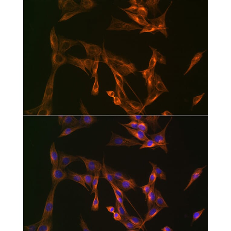 Immunofluorescence - Anti-Arp3 Antibody [ARC1067] (A306350) - Antibodies.com