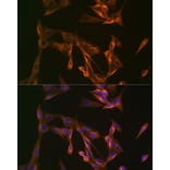 Immunofluorescence - Anti-Arp3 Antibody [ARC1067] (A306350) - Antibodies.com