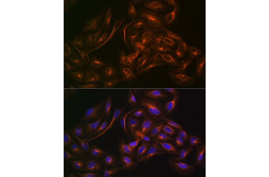 Immunofluorescence - Anti-Arp3 Antibody [ARC1067] (A306350) - Antibodies.com