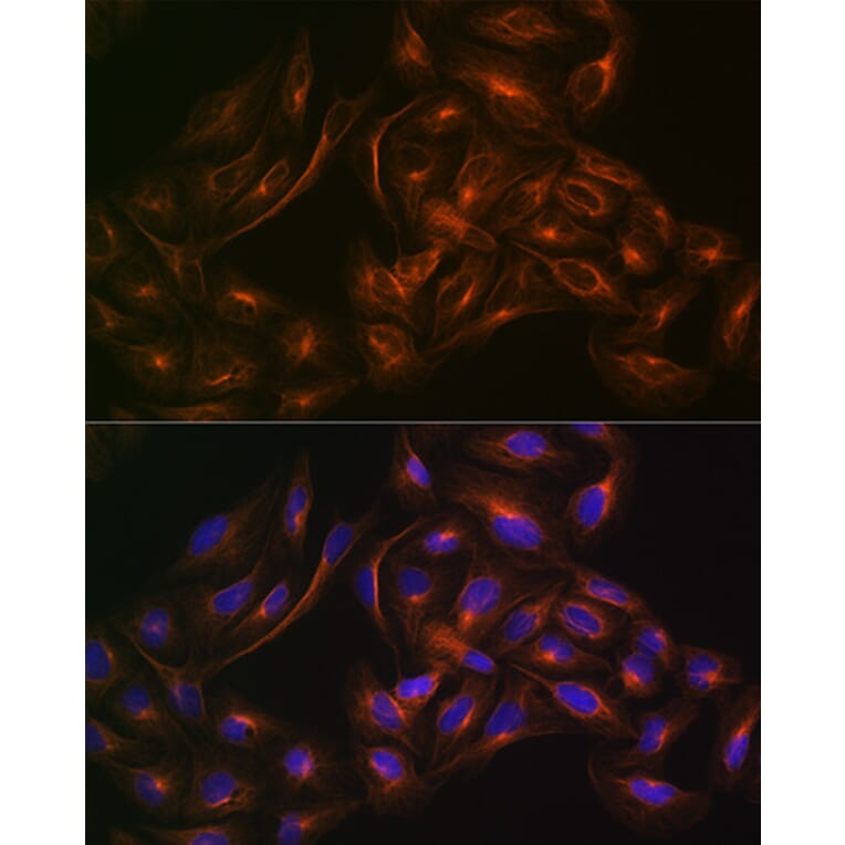 Immunofluorescence - Anti-Arp3 Antibody [ARC1067] (A306350) - Antibodies.com