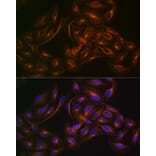 Immunofluorescence - Anti-Arp3 Antibody [ARC1067] (A306350) - Antibodies.com