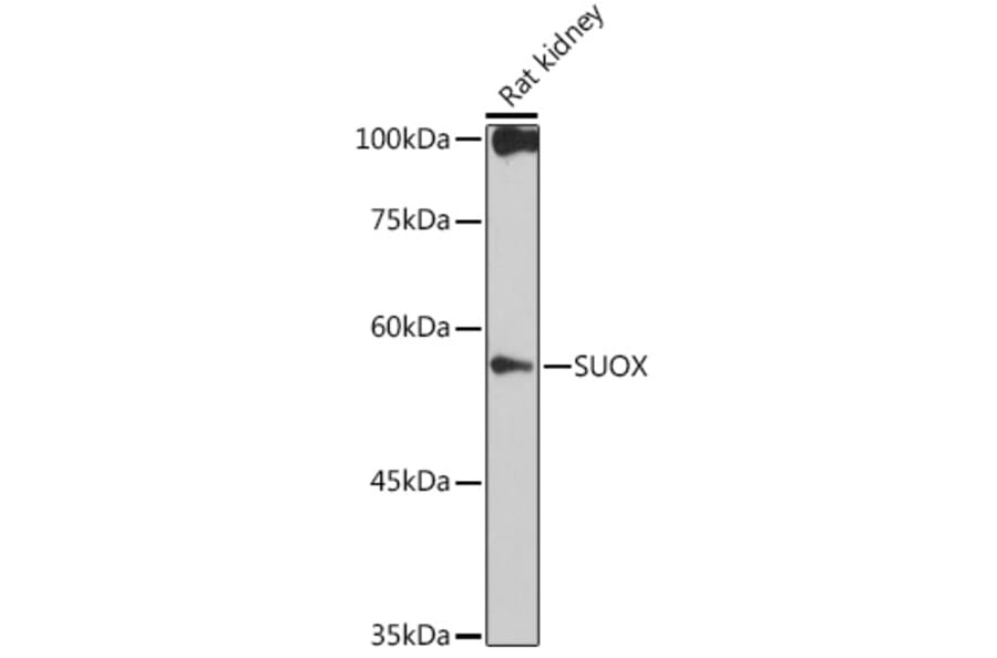 Western Blot - Anti-Sulfite oxidase Antibody [ARC2535] (A306351) - Antibodies.com