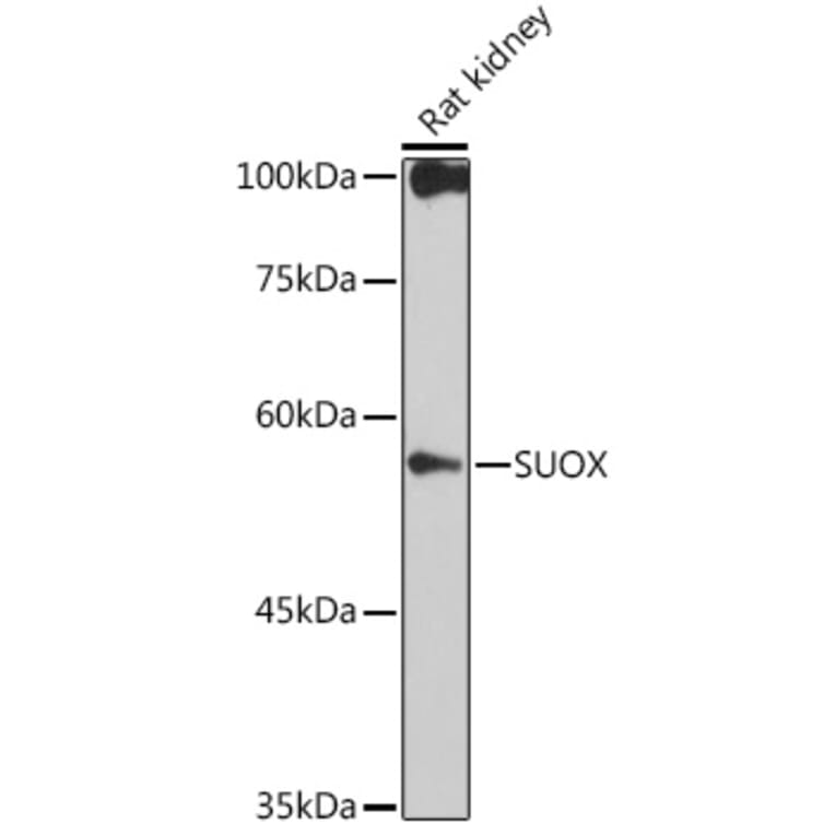 Western Blot - Anti-Sulfite oxidase Antibody [ARC2535] (A306351) - Antibodies.com