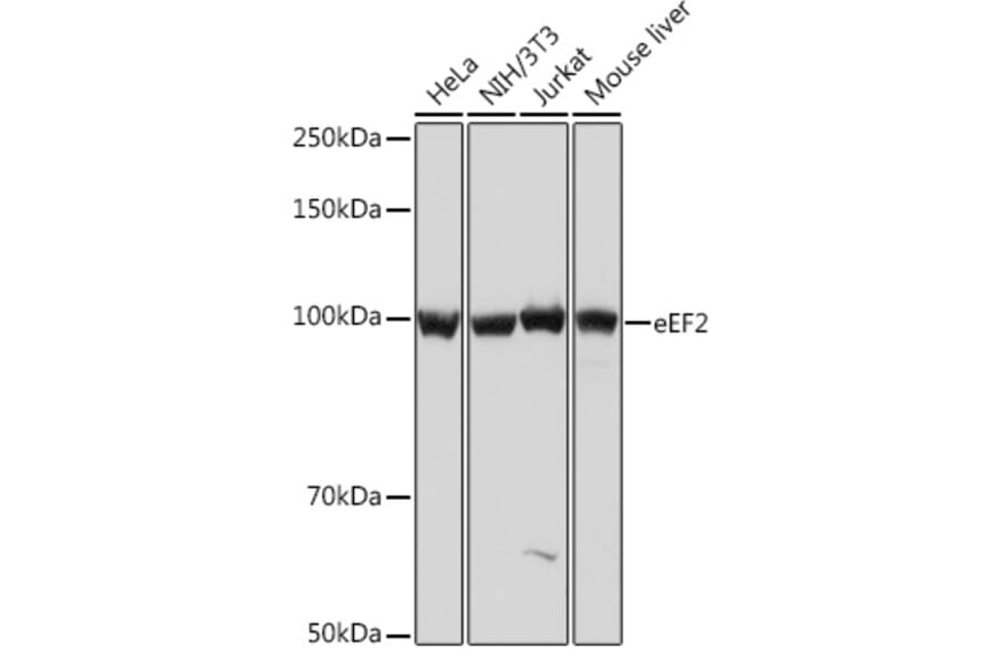 Western Blot - Anti-EEF2/Elongation factor 2 Antibody [ARC1717] (A306352) - Antibodies.com