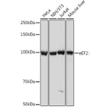 Western Blot - Anti-EEF2/Elongation factor 2 Antibody [ARC1717] (A306352) - Antibodies.com