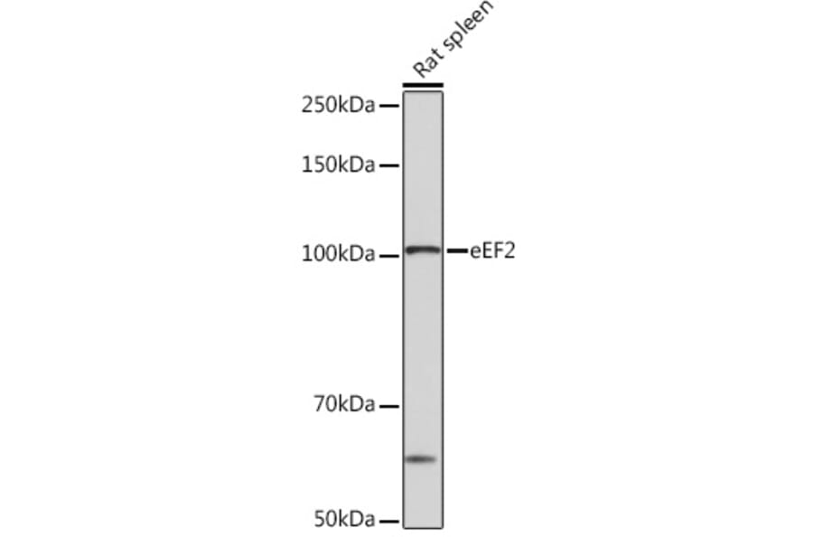 Western Blot - Anti-EEF2/Elongation factor 2 Antibody [ARC1717] (A306352) - Antibodies.com