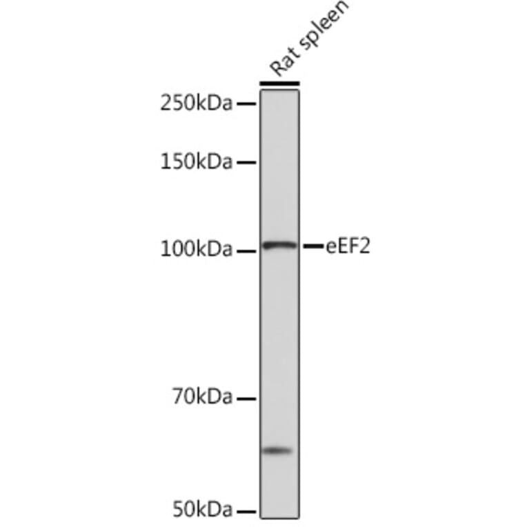 Western Blot - Anti-EEF2/Elongation factor 2 Antibody [ARC1717] (A306352) - Antibodies.com