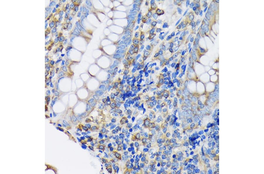 Immunohistochemistry - Anti-EEF2/Elongation factor 2 Antibody [ARC1717] (A306352) - Antibodies.com