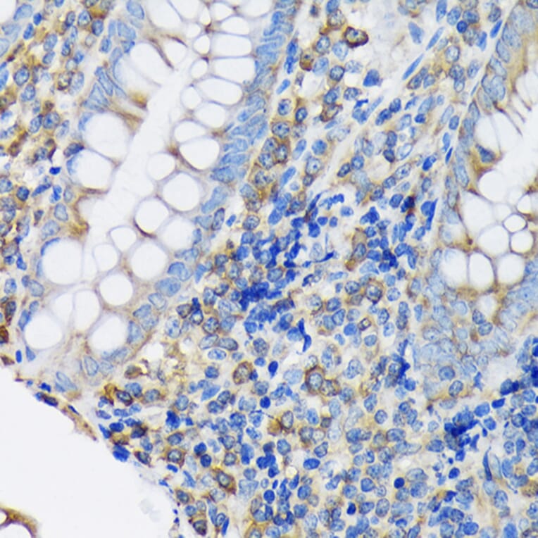 Immunohistochemistry - Anti-EEF2/Elongation factor 2 Antibody [ARC1717] (A306352) - Antibodies.com